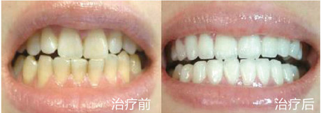 1448507478626912.jpg 1448507478626912.jpg