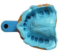 1465354914648279.png 传统方式取的牙模.png