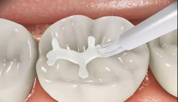 美奥口腔 全国连锁 12.jpg