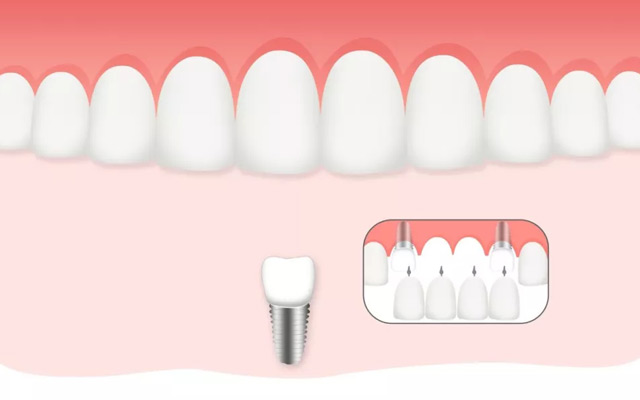 美奥口腔 全国连锁 6401-wps图片.jpg