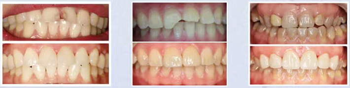 美奥口腔案例 美奥口腔案例